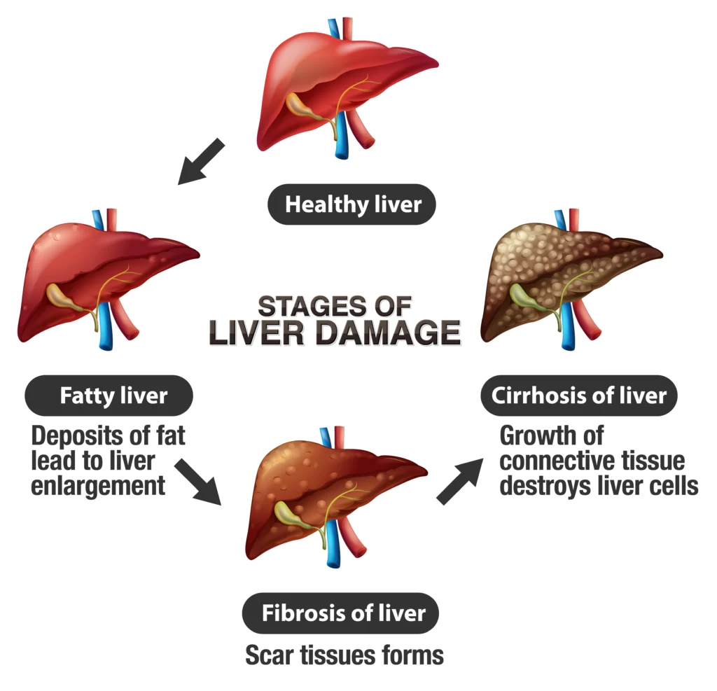 Liver Health Formula