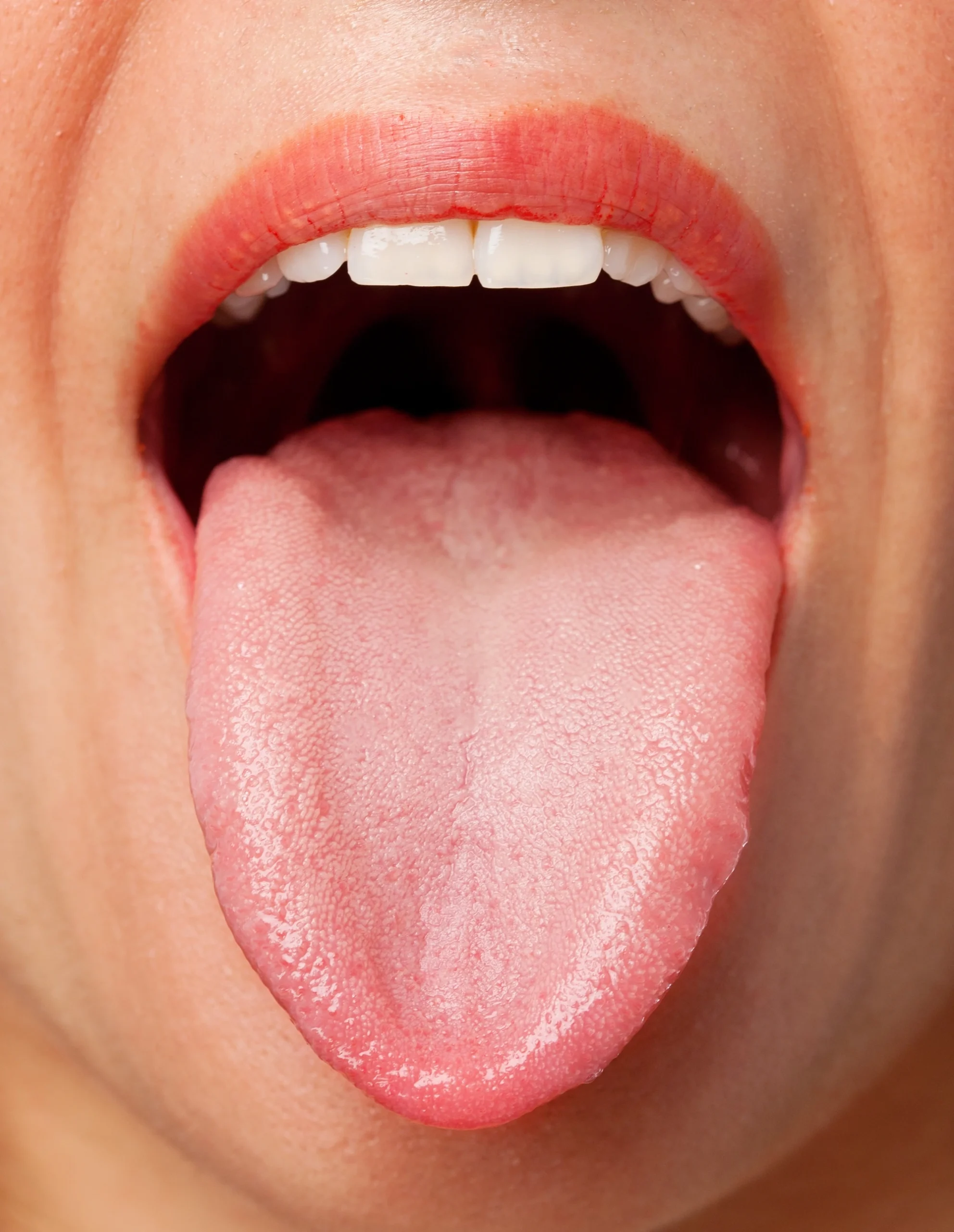 tongue health chart